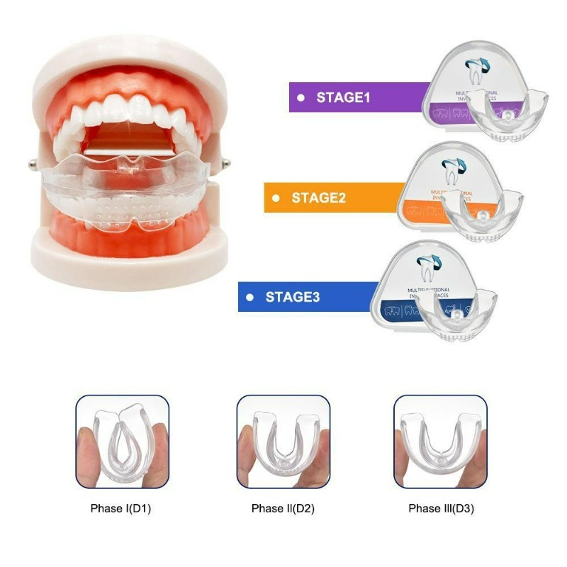 Dental Braces Teeth Trainer Al - Teeth Whitening For Braces avaliação e preço