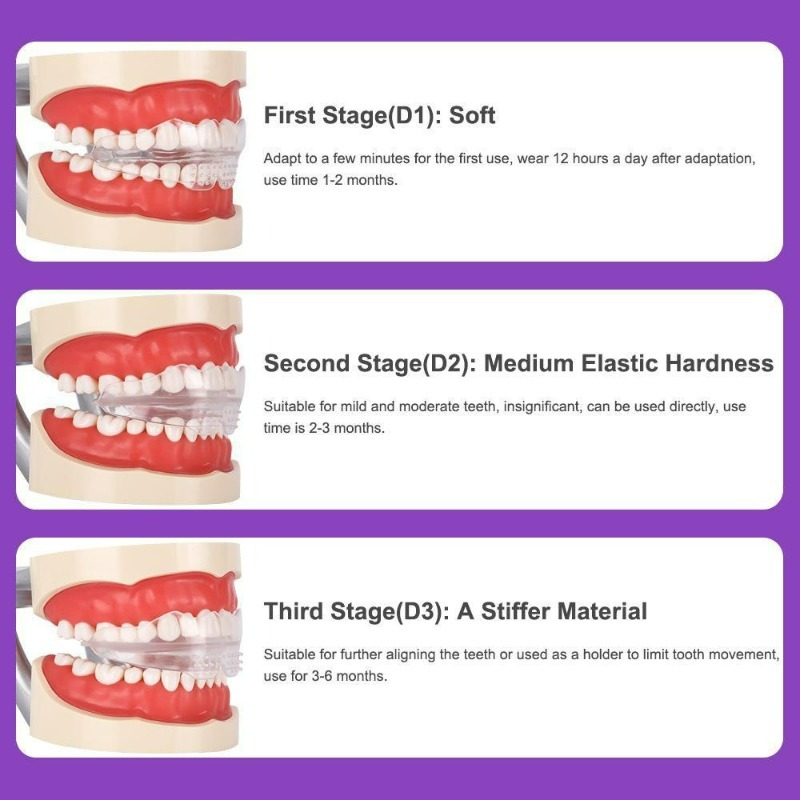 Dental Braces Teeth Trainer Al - Teeth Whitening For Braces avaliação e preço