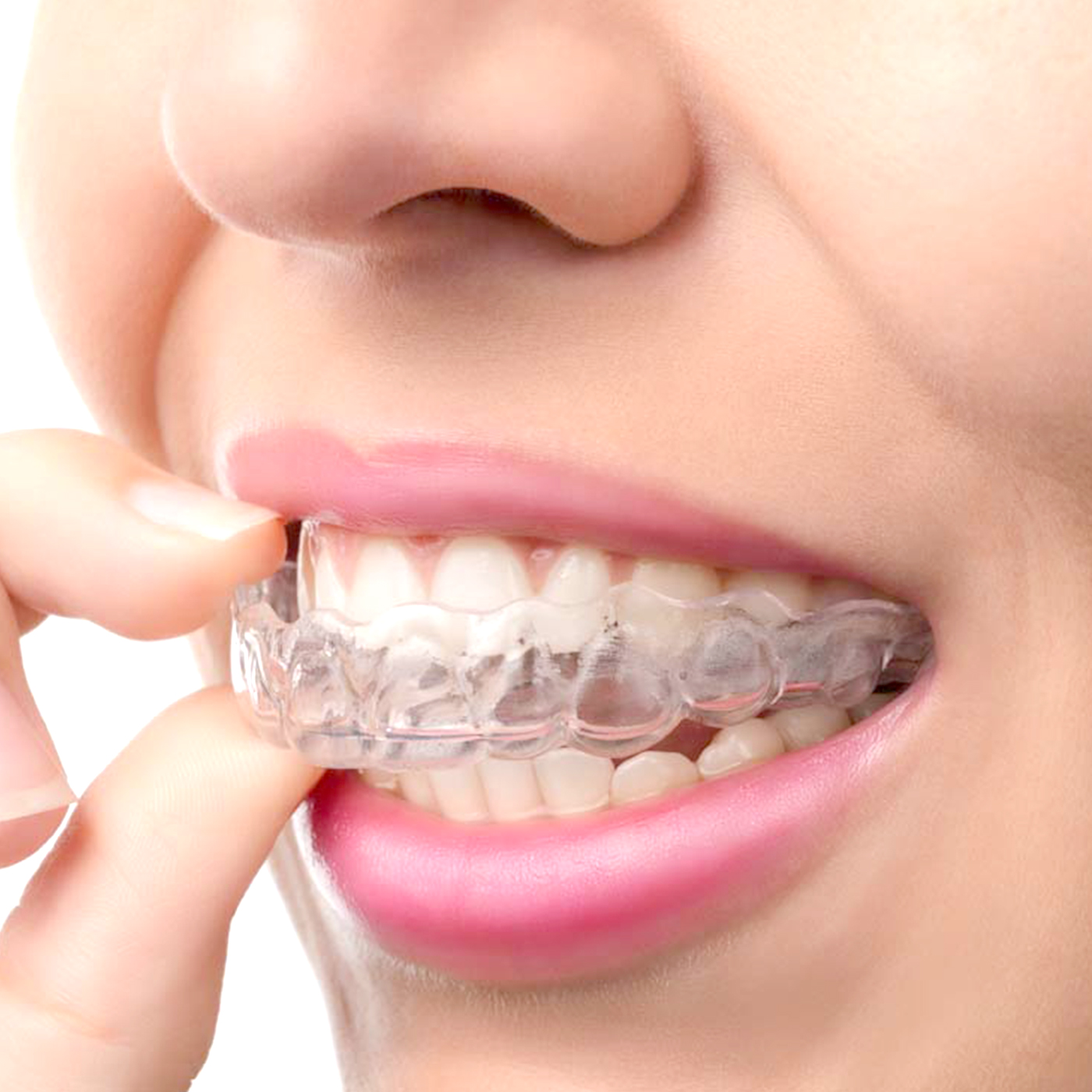 1Pc/2Pcs Transparent Teeth Tra - Teeth Whitening With Trays avaliação e preço