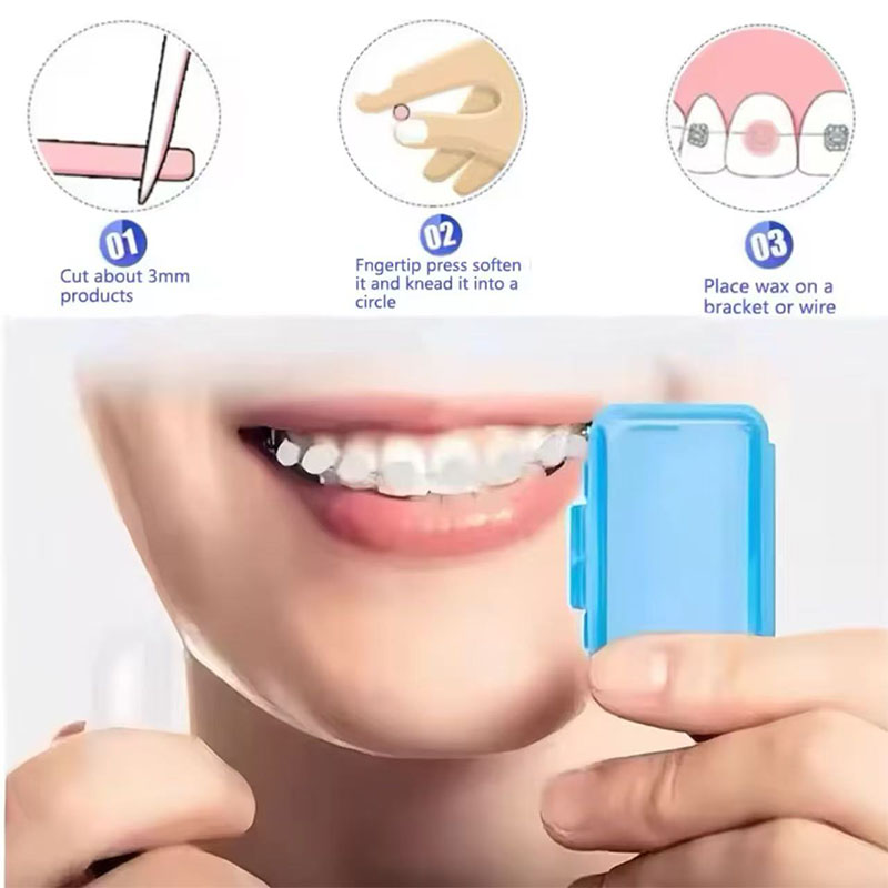 1set Orthodontic Dental Oral C - Teeth Whitening For Braces avaliação e preço