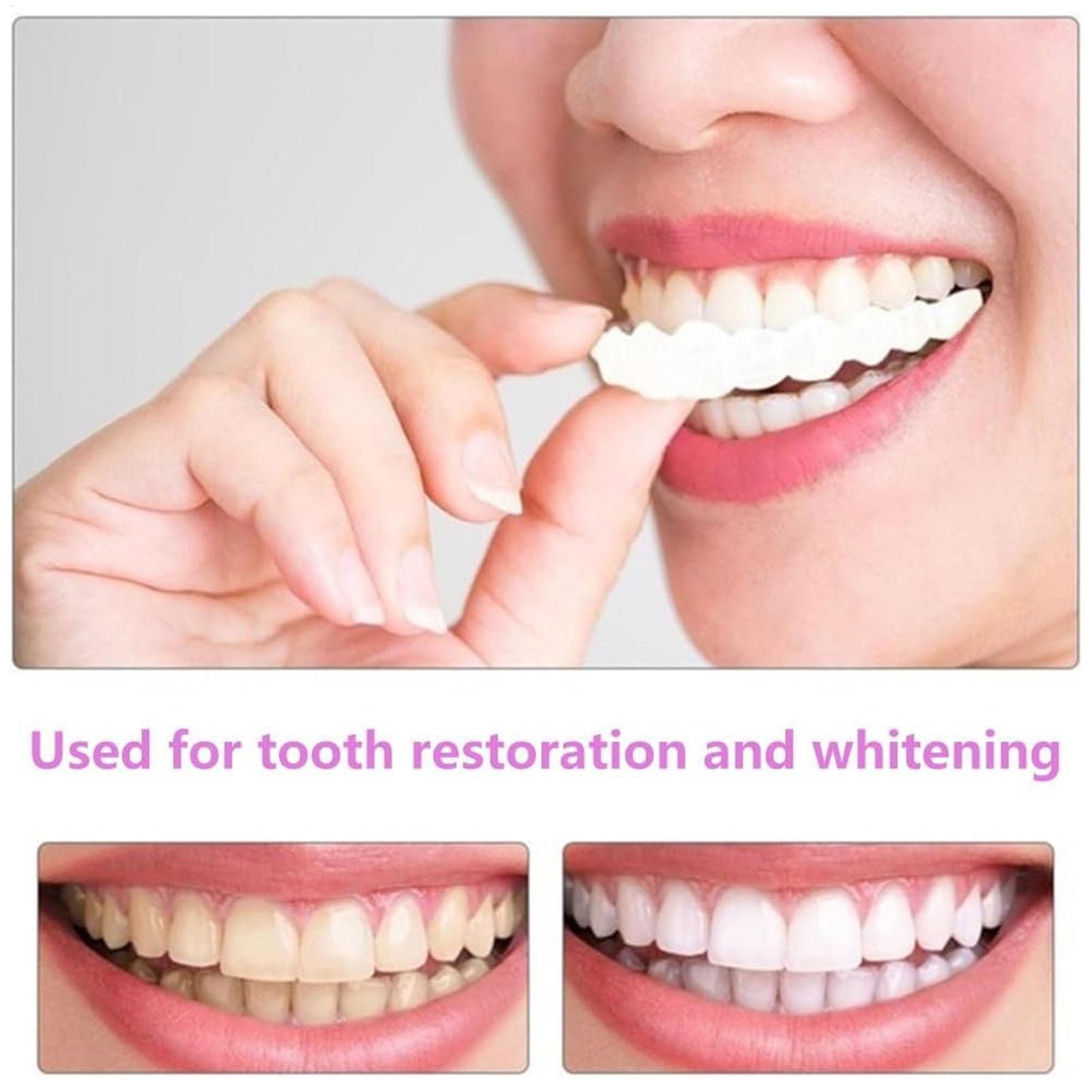 Dental Upper Lower Fake Teeth  - Teeth Whitening For Braces avaliação e preço