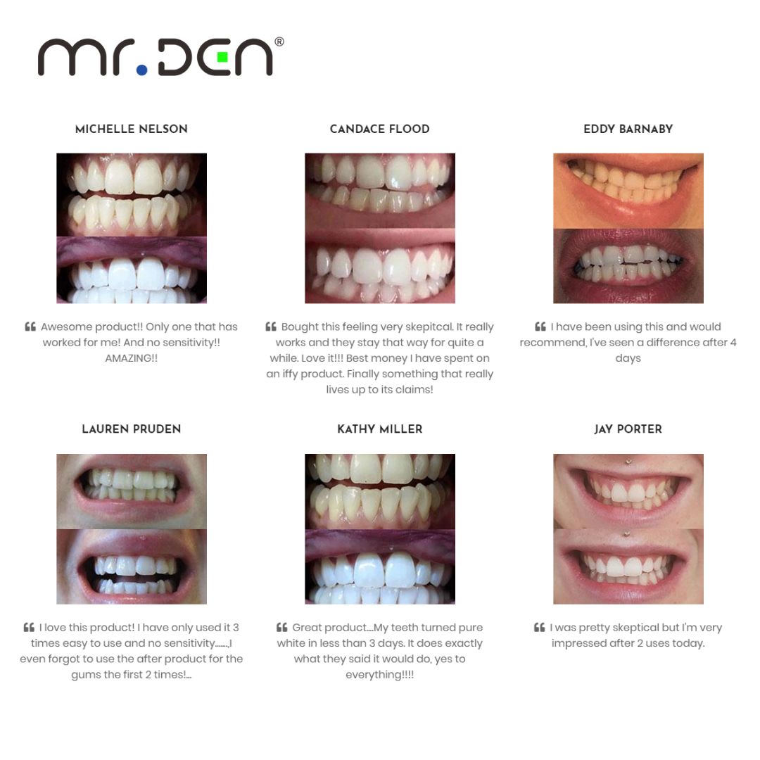 Dr. Whiten 3 Pack Teeth Whiten - Teeth Whitening Light Kit avaliação e preço