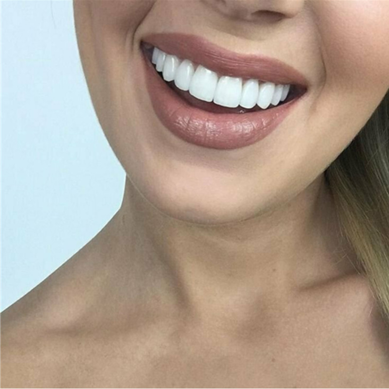 Latest Snap on Smile Dental Up - Teeth Whitening For Braces avaliação e preço