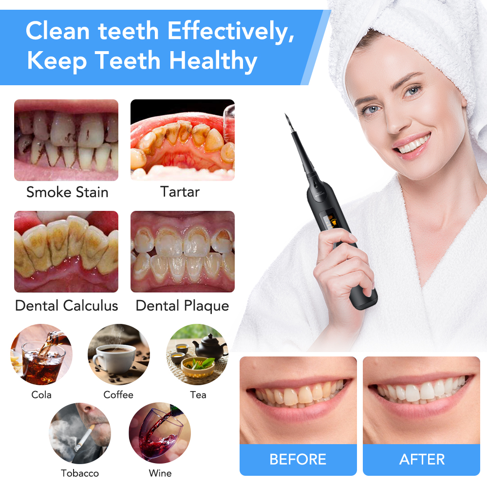 Teeth Tartar Remover Electric  - Teeth Whitening Light Kit avaliação e preço