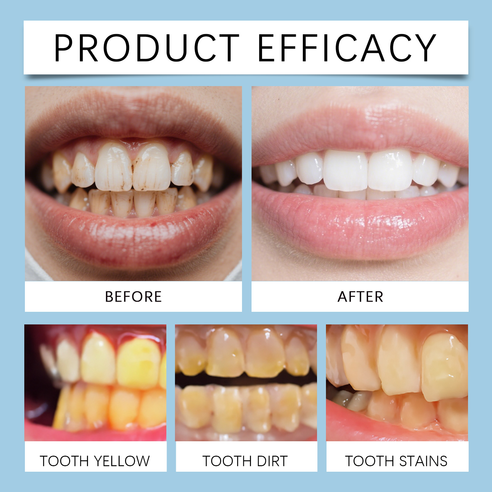 Feimuko 8ml Teeth Gel Pen Gent - Teeth Whitening App avaliação e preço