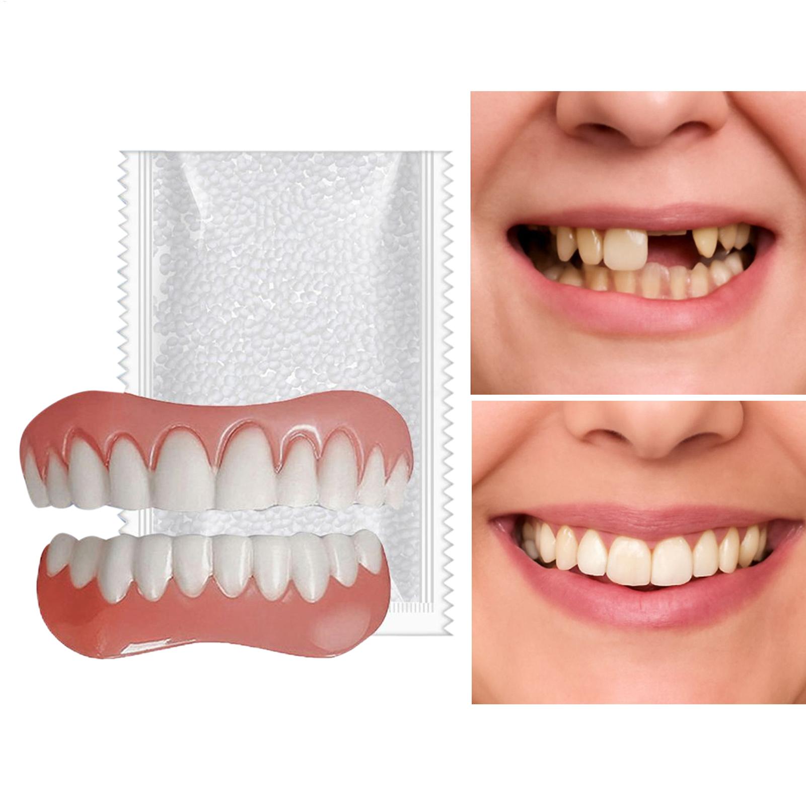 Denture Kit Resin Denture Rest - Teeth Whitening For Braces avaliação e preço
