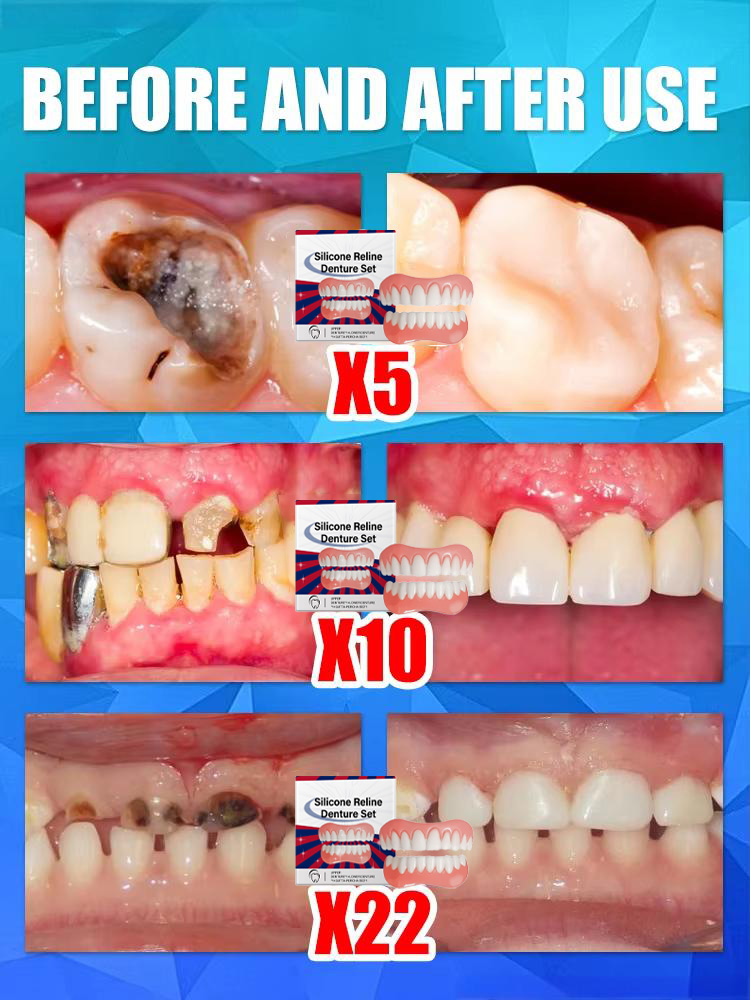 False Teeth Silicone Upper Low - Teeth Whitening For Braces avaliação e preço