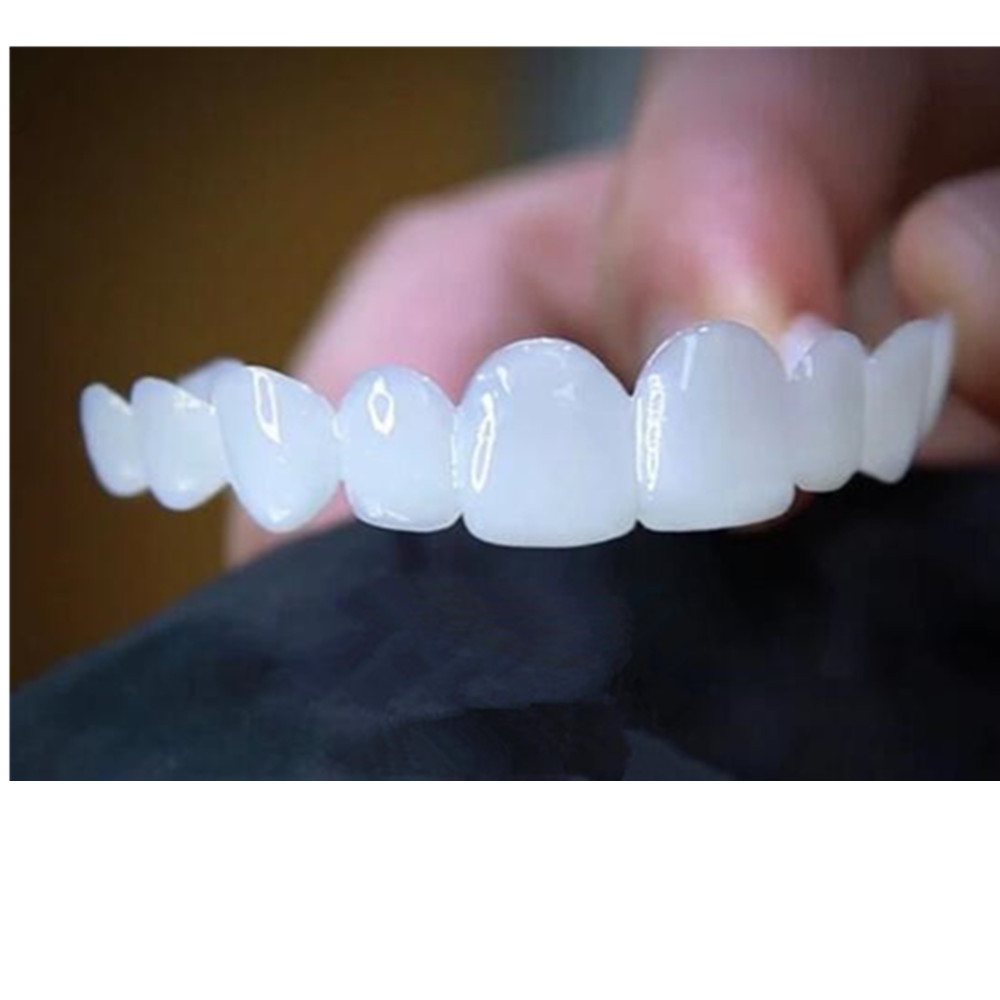 Whitening Teeth Veneers Tempor - Teeth Whitening For Braces avaliação e preço