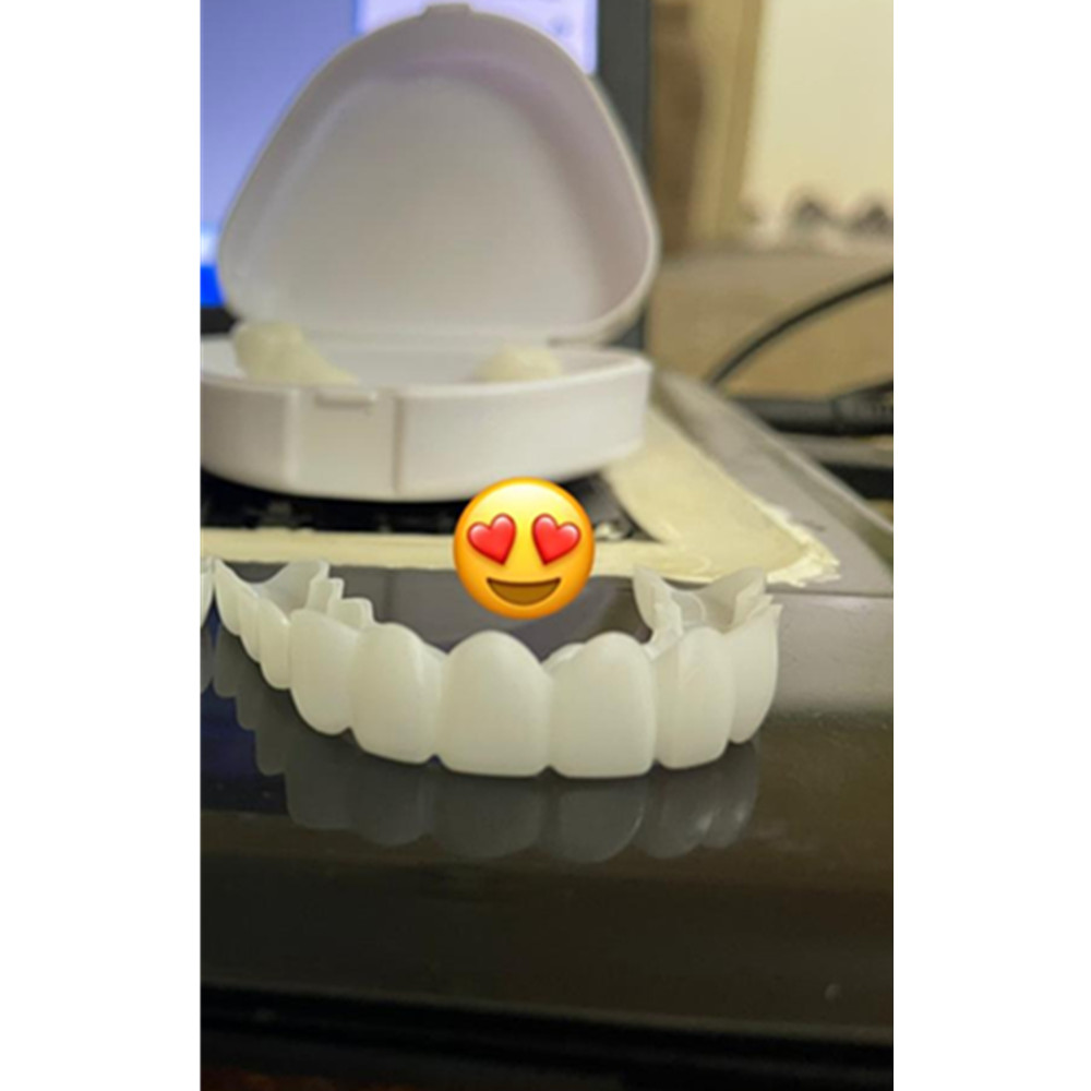 On Smile Dental Upper Lower Fa - Teeth Whitening For Braces avaliação e preço