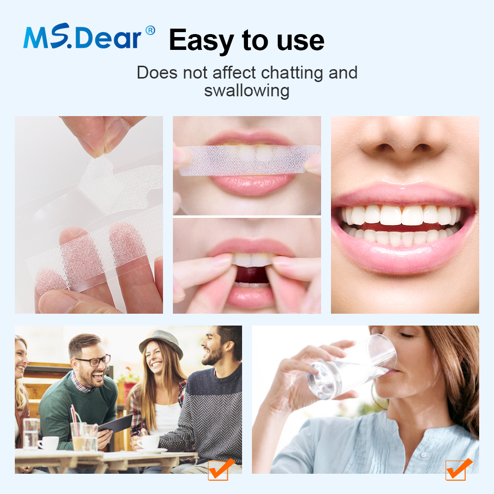 Teeth Whitening Strips Cleansi - Teeth Whitening Results avaliação e preço